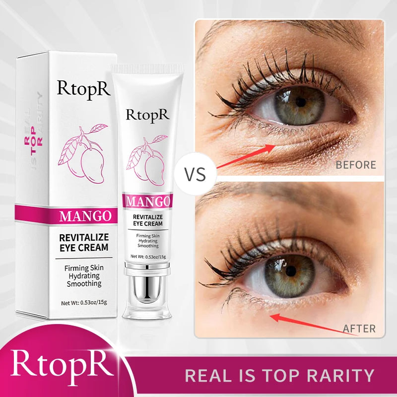 Anti-Wrinkle Eye Cream
