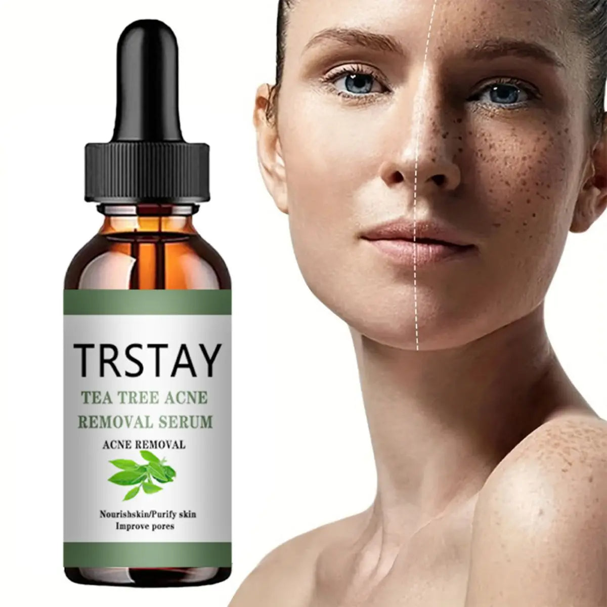 Acne Treatment Face Serum