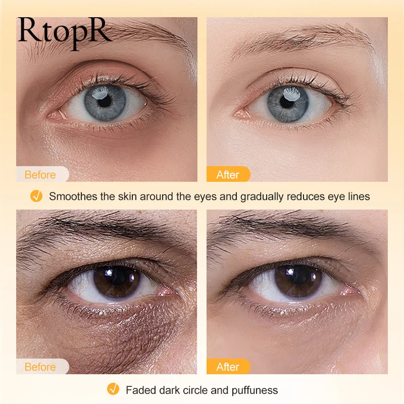 Anti-Wrinkle Eye Cream