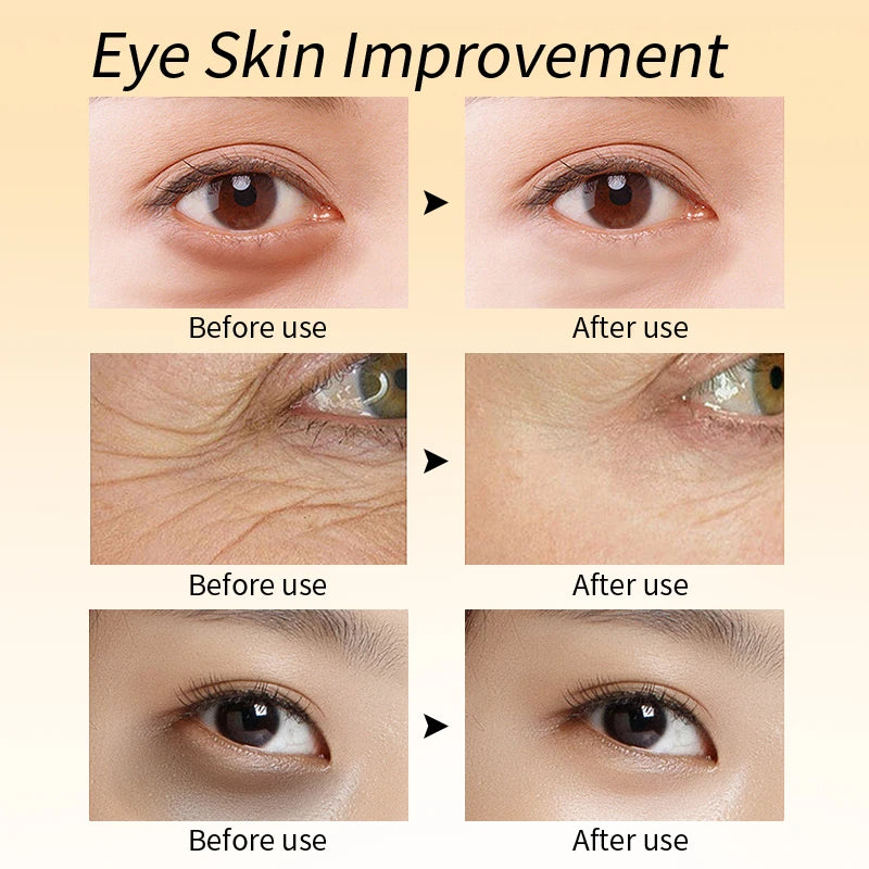 Anti-Wrinkle Eye Cream