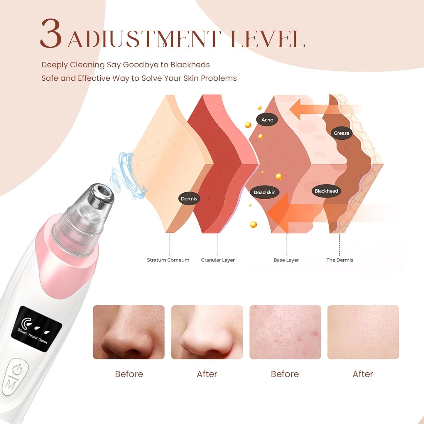 2024 Newest Blackhead Remover Pore Vacuum,Facial Pore Cleaner-5 Suction Power,5 Probes,Usb Rechargeable Blackhead Vacuum Kit Electric Acne Extractor Tool for Adult